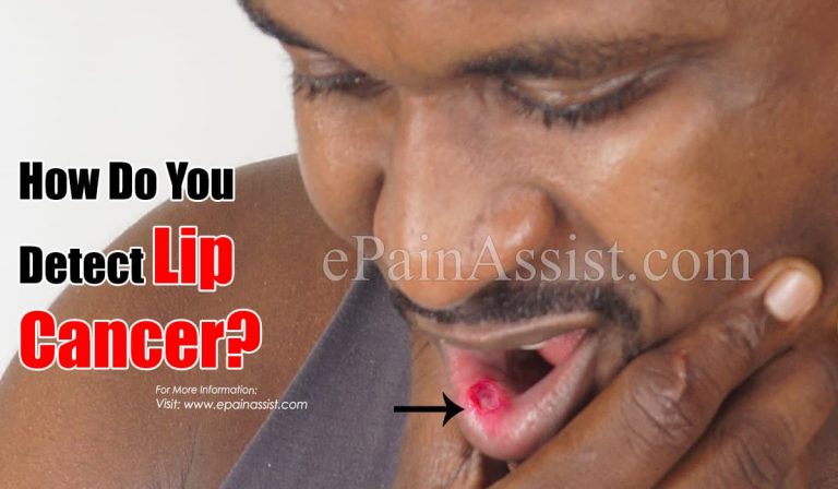 How Do You Detect Lip Cancer?
