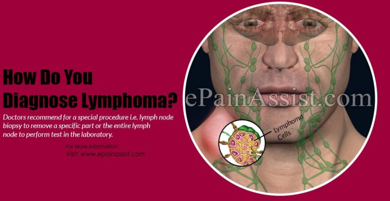 How Do You Diagnose Lymphoma?