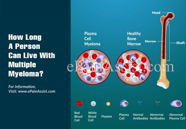 How Long A Person Can Live With Multiple Myeloma?