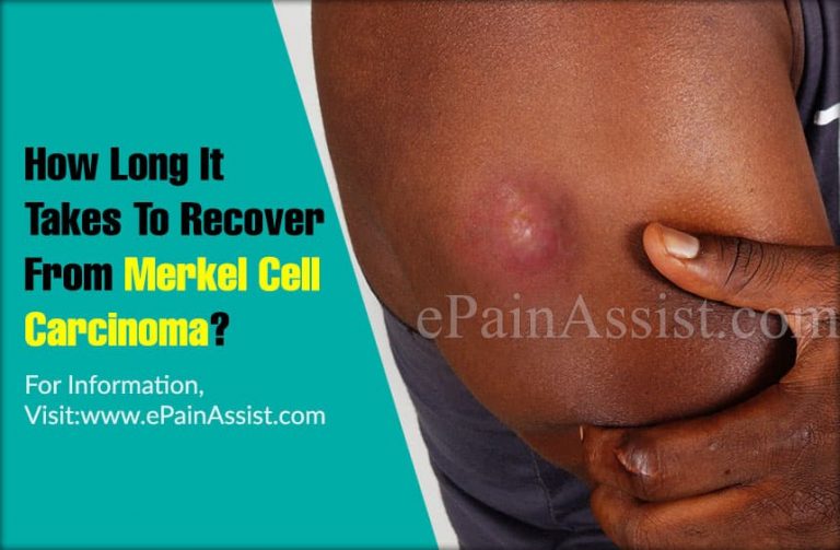 How Long Will It Take To Recover From Merkel Cell Carcinoma & How Long Does the Symptoms Last?