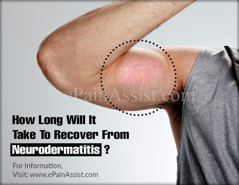 How Long Will It Take To Recover From Neurodermatitis & How Long Does The Symptoms Last?