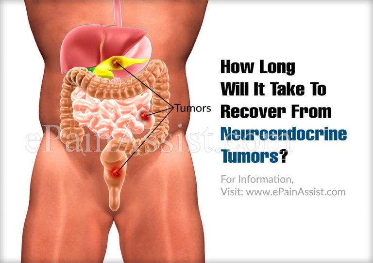 How Long Will It Take To Recover From Neuroendocrine Tumors & How Long Does The Symptoms Last?