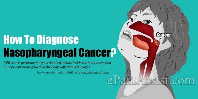 How To Diagnose Nasopharyngeal Cancer & What Is The Best Medicine For It?