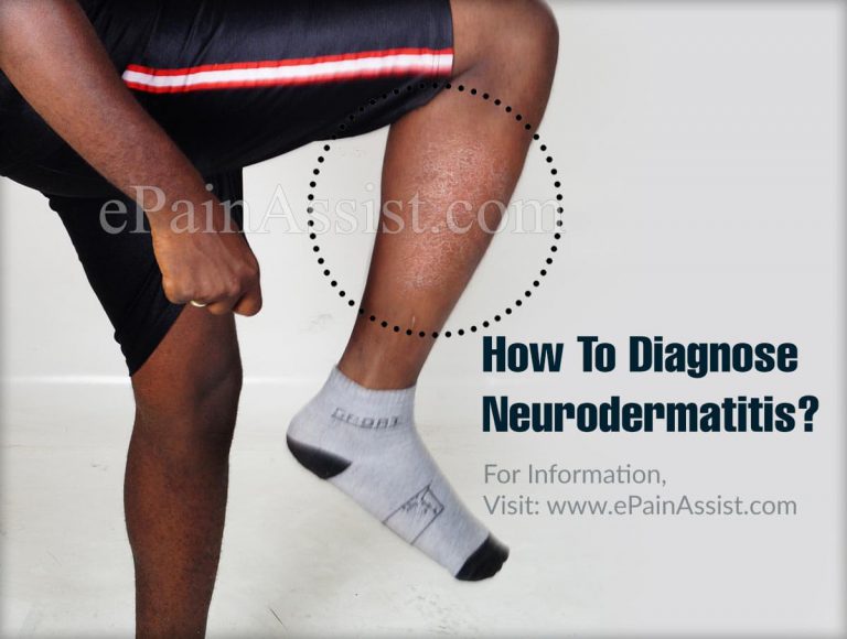 How To Diagnose Neurodermatitis & What Is The Best Medicine For It?