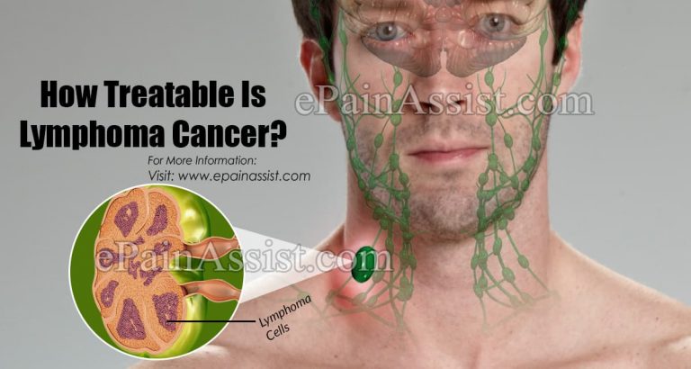 How Treatable Is Lymphoma Cancer?