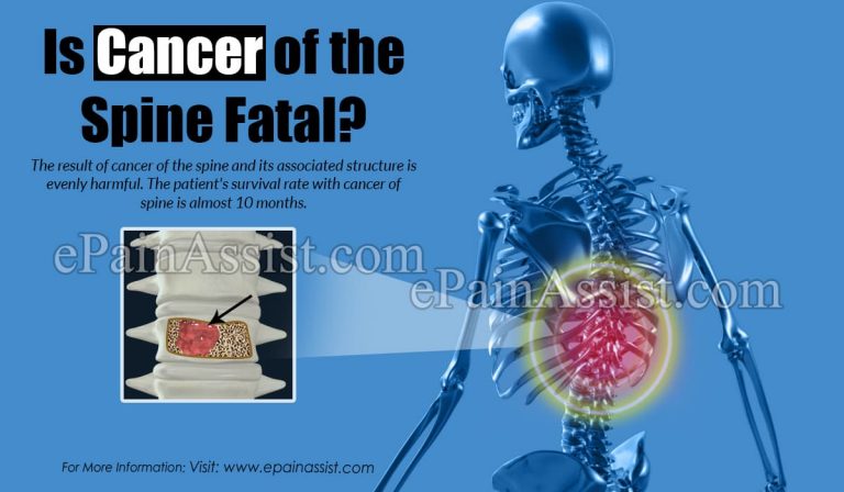 Is Cancer of the Spine Fatal?