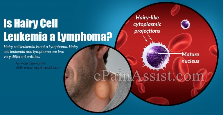 Is Hairy Cell Leukemia B Cell Lymphoma?