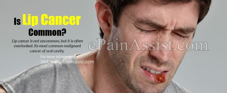 Is Lip Cancer Common?
