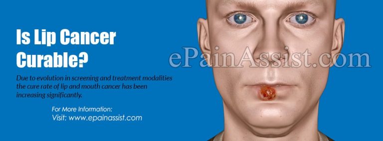 Is Lip Cancer Curable?
