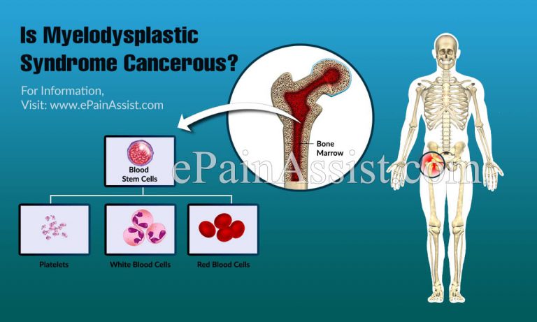 Is Myelodysplastic Syndrome Cancerous?
