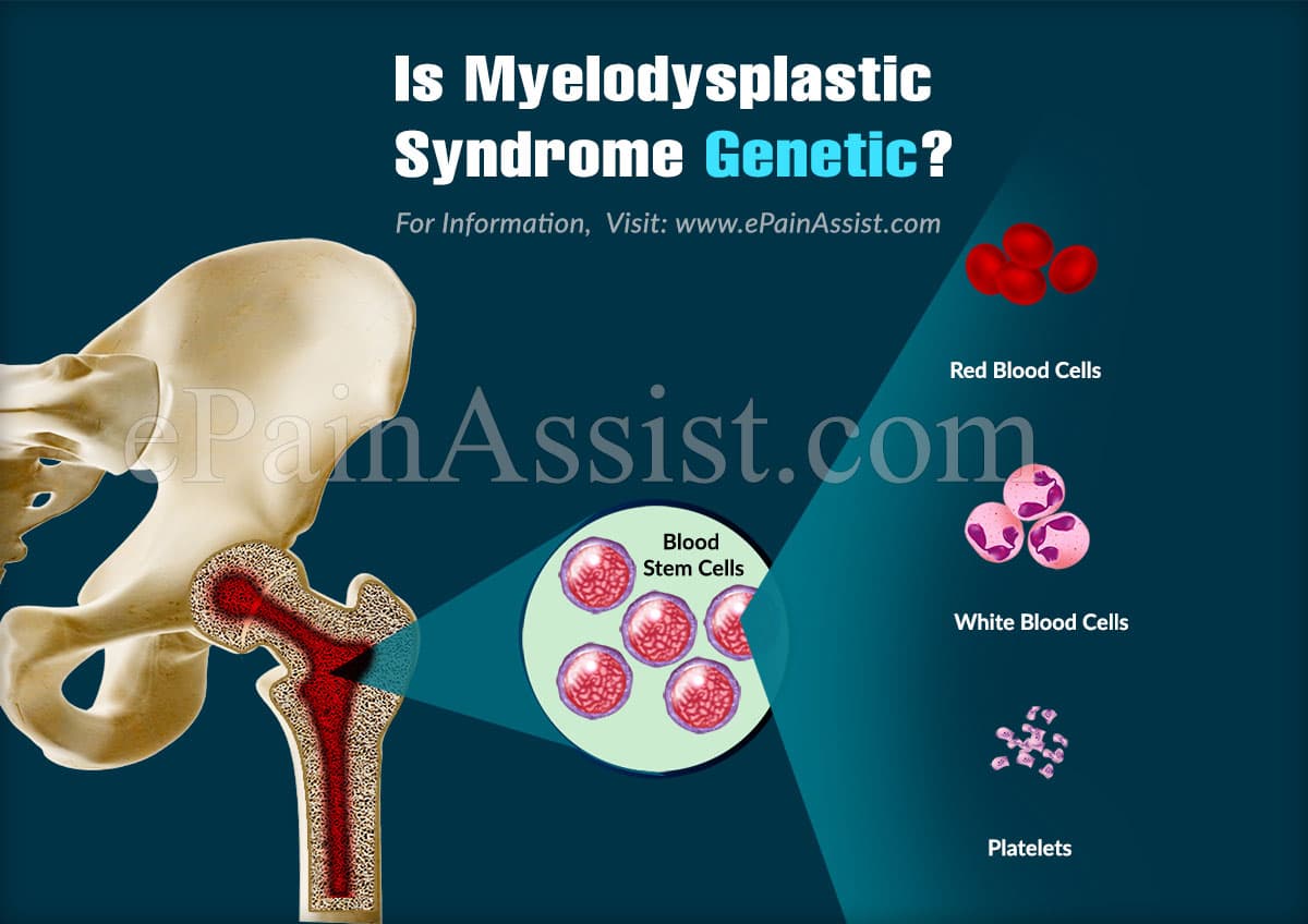 Is Myelodysplastic Syndrome Genetic?