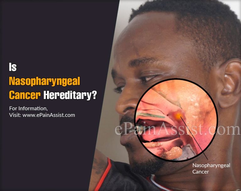 Is Nasopharyngeal Cancer Hereditary & Can It Be Painful?