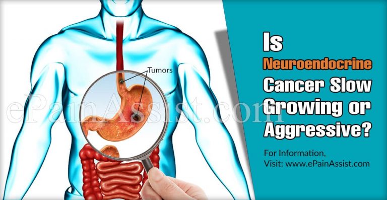 Is Neuroendocrine Cancer Slow Growing or Aggressive?