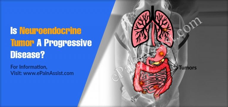 Is Neuroendocrine Tumor A Progressive Disease & What Are Its Alternative Treatments?