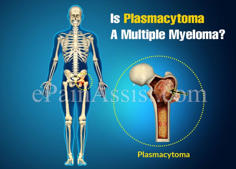 Is Plasmacytoma A Multiple Myeloma?