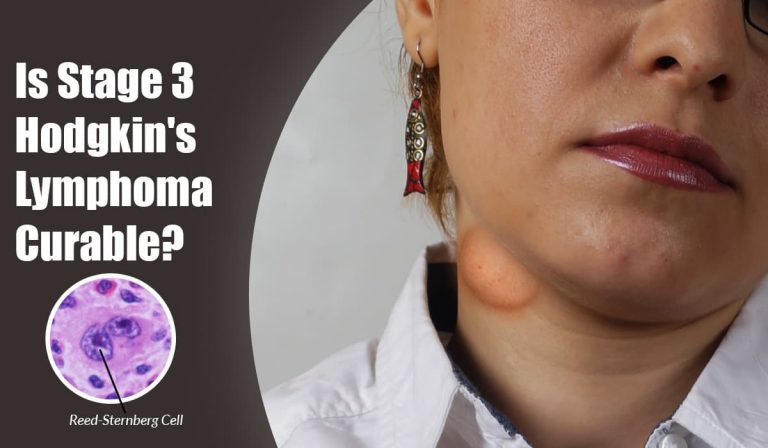 Is Stage 3 Hodgkin’s Lymphoma Curable?
