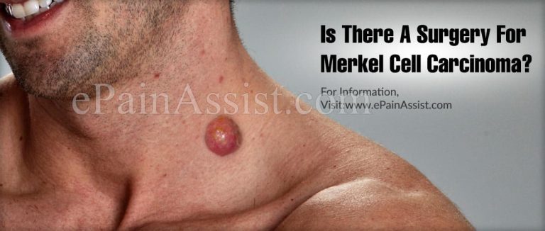 Is There A Surgery For Merkel Cell Carcinoma?