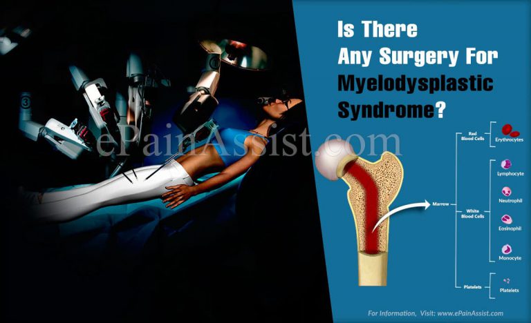 Is There Any Surgery For Myelodysplastic Syndrome?
