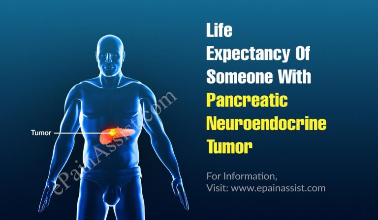 Life Expectancy Of Someone With Pancreatic Neuroendocrine Tumor