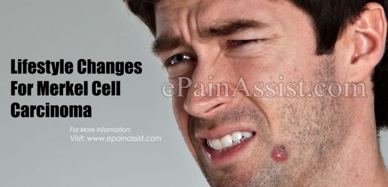 Lifestyle Changes For Merkel Cell Carcinoma