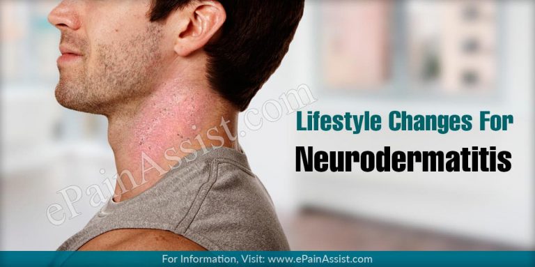 Lifestyle Changes For Neurodermatitis