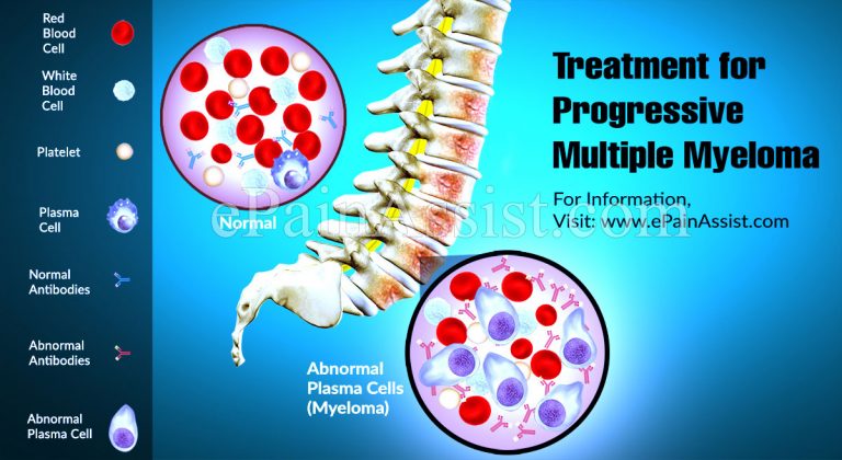 Treatment Options for Progressive Multiple Myeloma