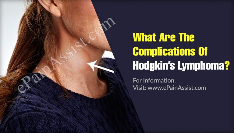 What Are The Complications Of Hodgkin’s Lymphoma?
