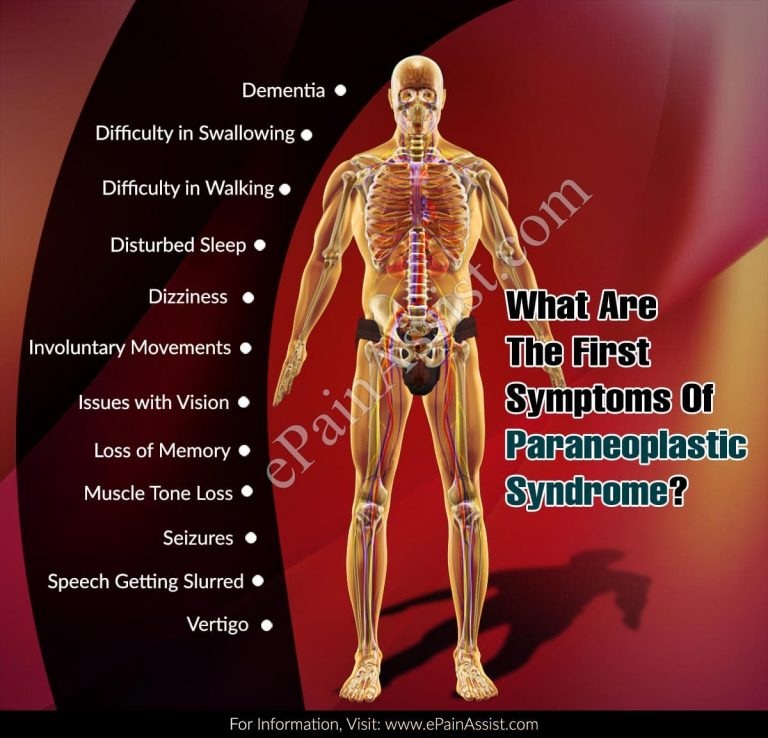 What Are The First Symptoms Of Paraneoplastic Syndrome & How Do You Test For It?