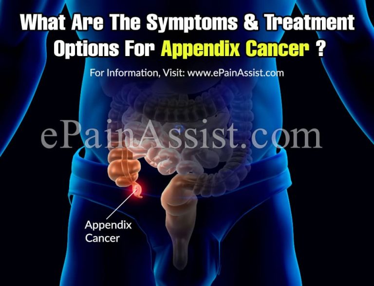 What Are The Symptoms And Treatment Options For Appendix Cancer?