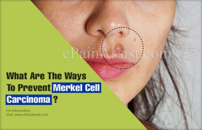 What Are The Ways To Prevent Merkel Cell Carcinoma & Does It Reoccur?