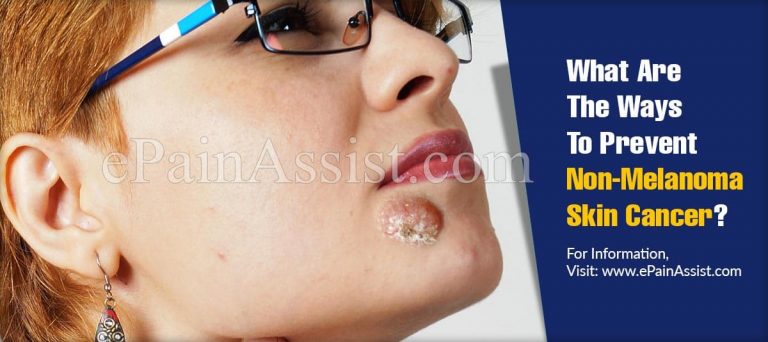 What Are The Ways To Prevent Non-Melanoma Skin Cancer & Does It Reoccur?