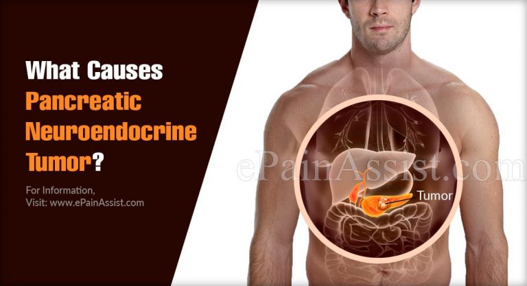 What Causes Pancreatic Neuroendocrine Tumor & Is It Curable?