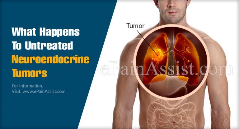 What Happens To Untreated Neuroendocrine Tumors & When To Go To Doctor?