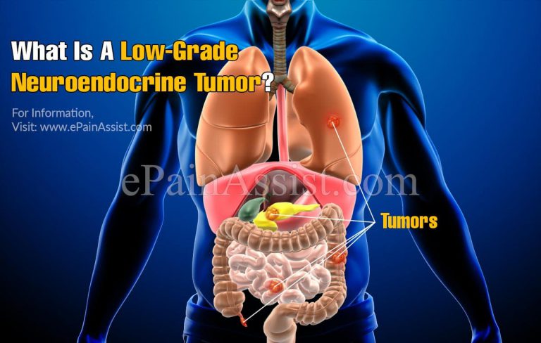 What Is A Low-Grade Neuroendocrine Tumor & Are Neuroendocrine Tumors Always Cancerous?