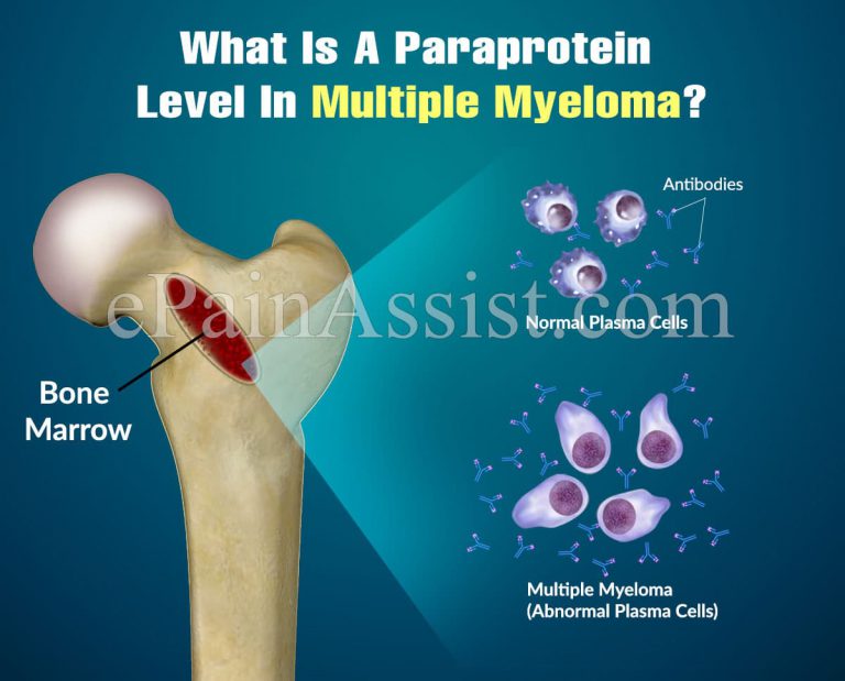 What Is A Paraprotein Level In Multiple Myeloma?