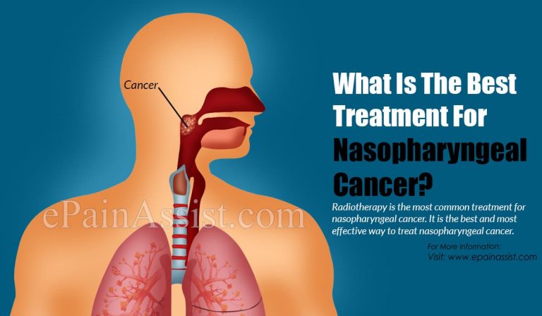 What Is The Best Treatment For Nasopharyngeal Cancer?