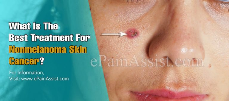 What Is The Best Treatment For Nonmelanoma Skin Cancer?