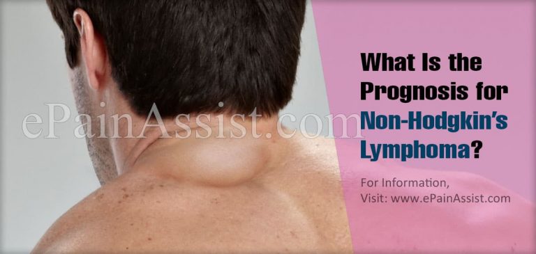 What Is the Prognosis for Non-Hodgkin’s Lymphoma?
