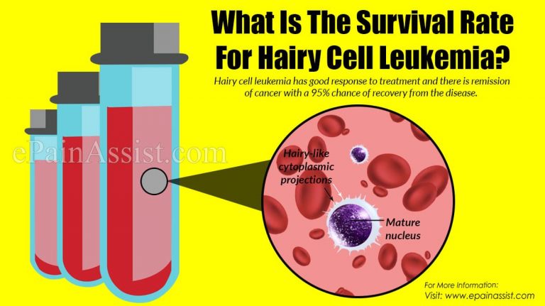 What Is The Survival Rate For Hairy Cell Leukemia?