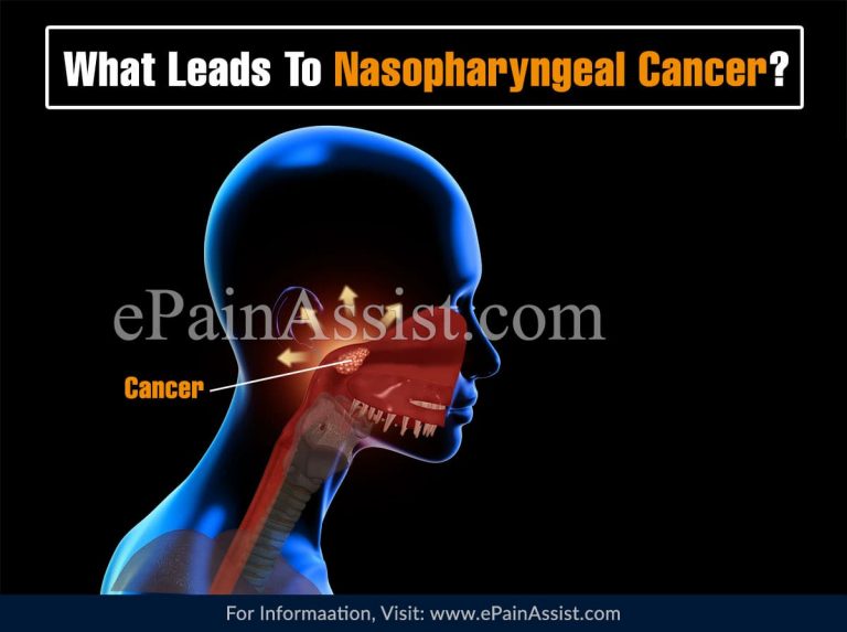 What Leads To Nasopharyngeal Cancer & Can It Be Cured?