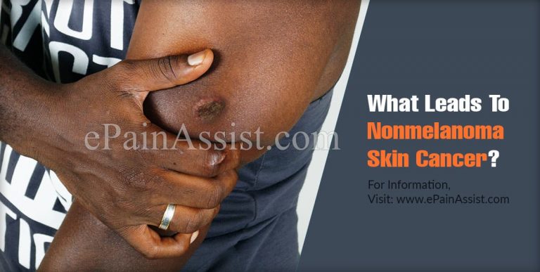 What Leads To Nonmelanoma Skin Cancer & Can It Be Cured?