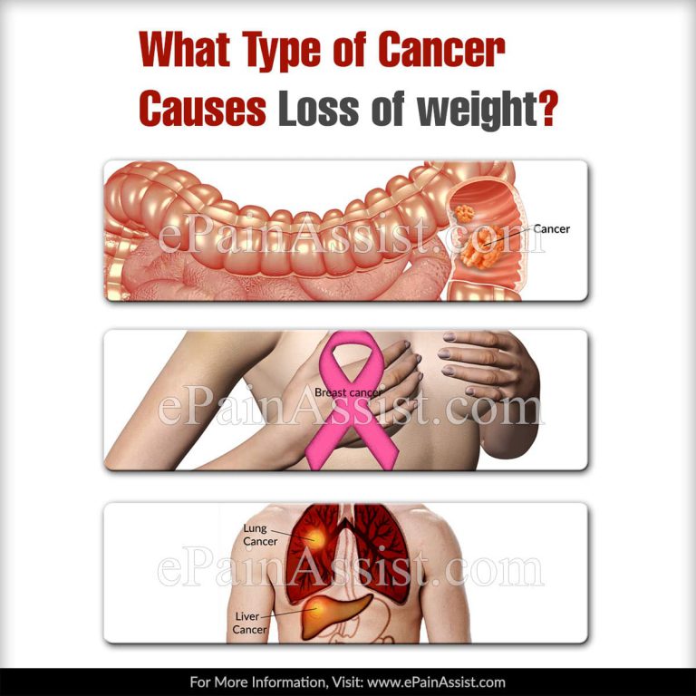 What Type of Cancer Causes Loss of Weight?
