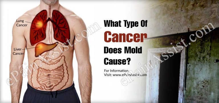 What Type Of Cancer Does Mold Cause?
