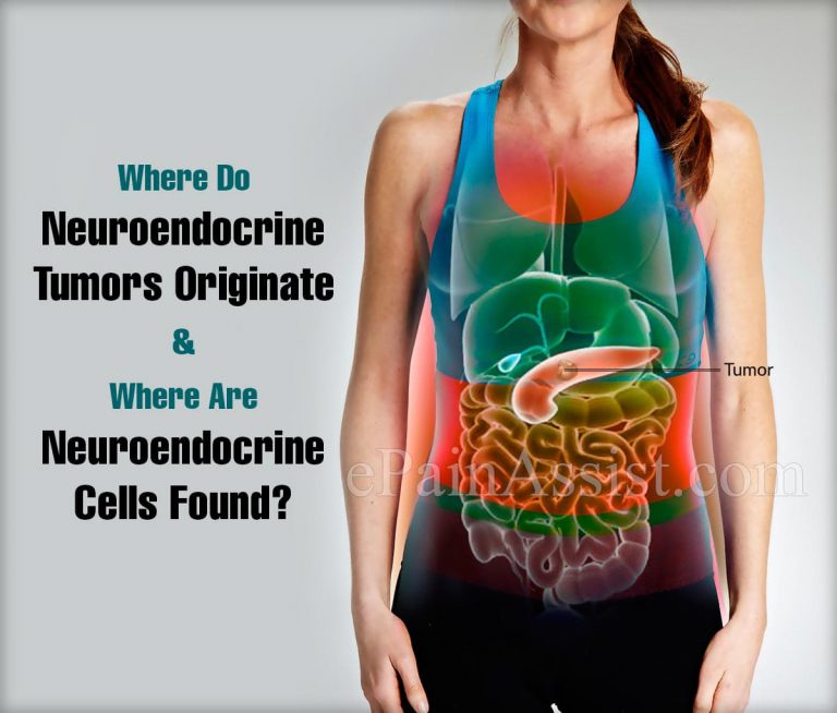 Where Do Neuroendocrine Tumors Originate & Where Are Neuroendocrine Cells Found?