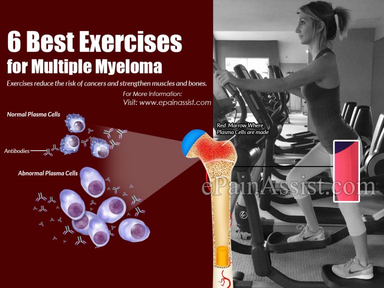 6 Best Exercises for Multiple Myeloma