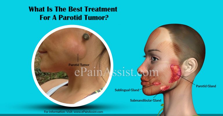 What Is The Best Treatment For Parotid Tumor & Coping Methods For It?
