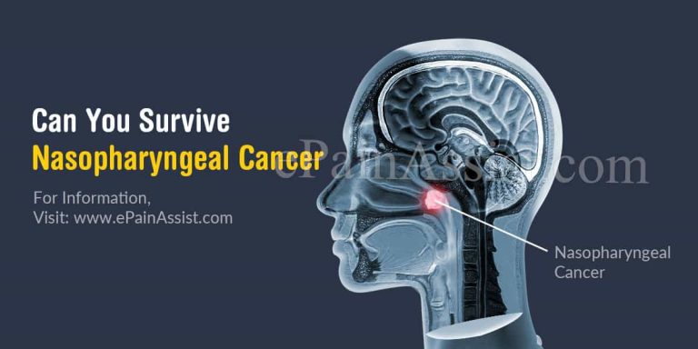 Can You Survive Nasopharyngeal Cancer & What Is Its Survival Rate?