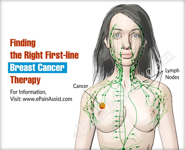Finding the Right First-line Breast Cancer Therapy