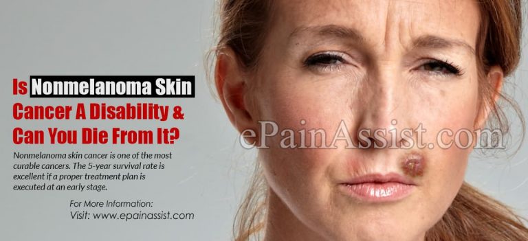 Is Nonmelanoma Skin Cancer A Disability & Can You Die From It?