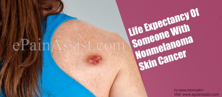 Life Expectancy Of Someone With Nonmelanoma Skin Cancer